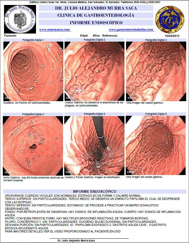 Endoscopia El Salvador Dr. Murra Saca
